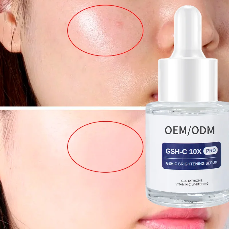 Anti-acne and anti-spot facial serum Whitening and anti-wrinkle Glutathione Kojic Acid Serum