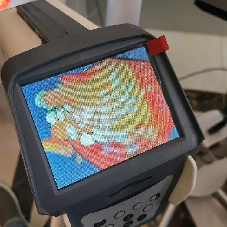 Medical Digital Video Colposcope For Vagina Colposcope Price