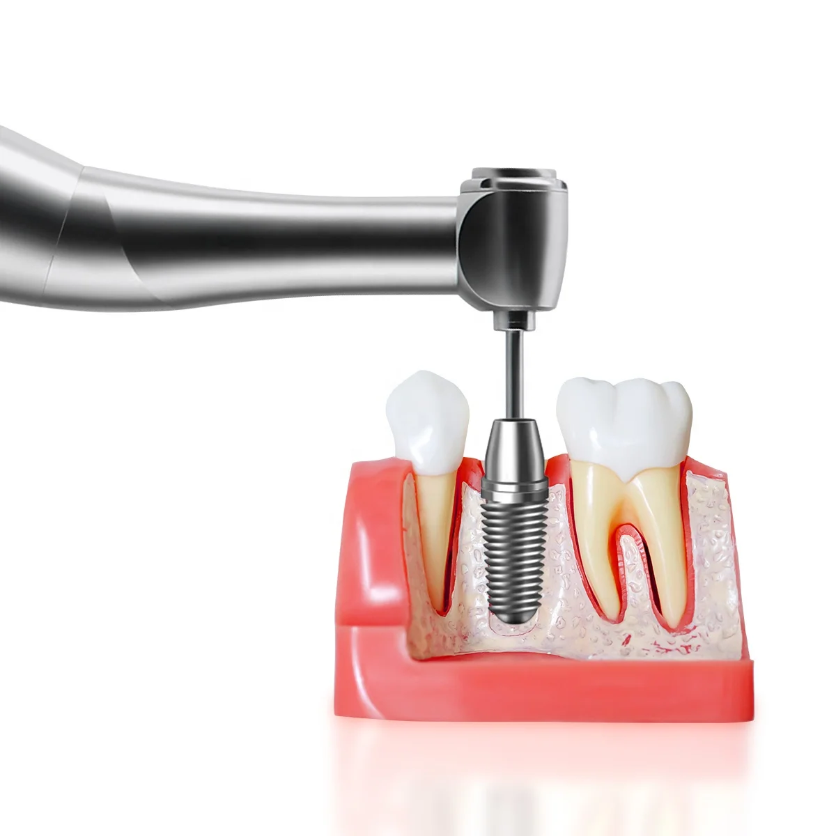 Dental Electric Wireless Torque Driver Implant Torque Wrench Motor Kit