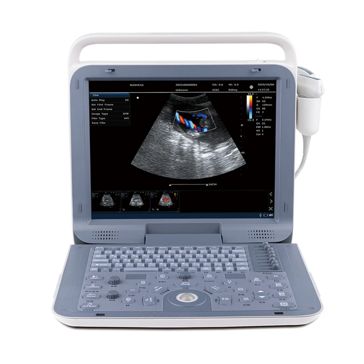 Veterinary Ultrasound Color Doppler 15 Inches Pregnancy Scanner Vet Portable Ultrasound for Animal