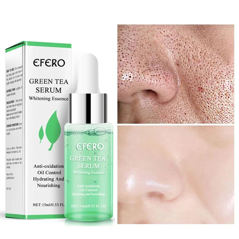 Green Tea Oil Control Pore Shrink Face Serum Whitening Remove Dark Spots Improve Acne Blackheads Dry Skin Care Korean Cosmetics