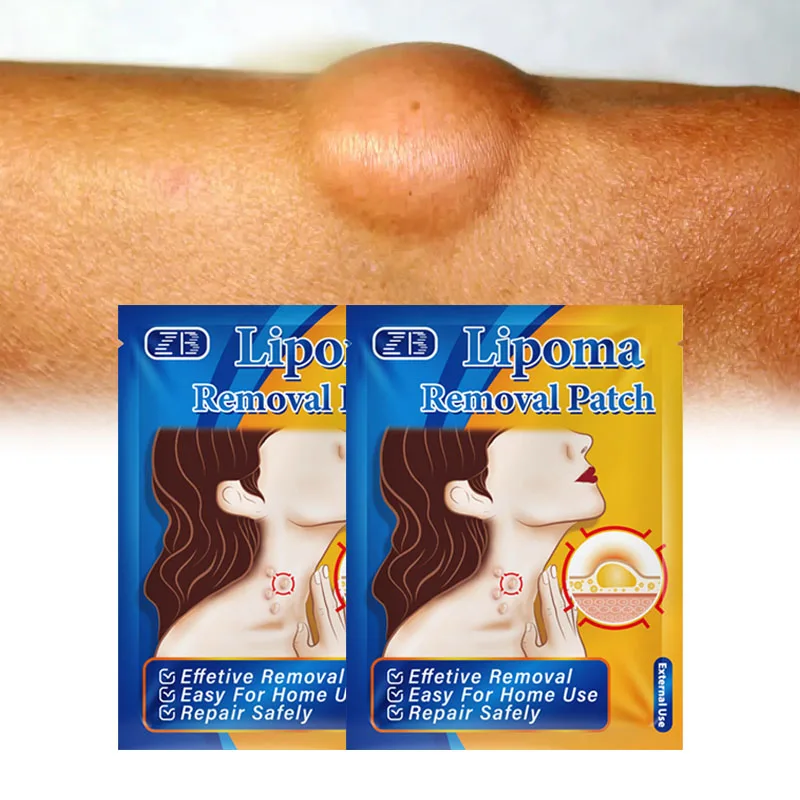6 patches/bag Lipoma Removal Patch Removes Fibroids Lumps Pain Plaster Chinese Herbal Patches