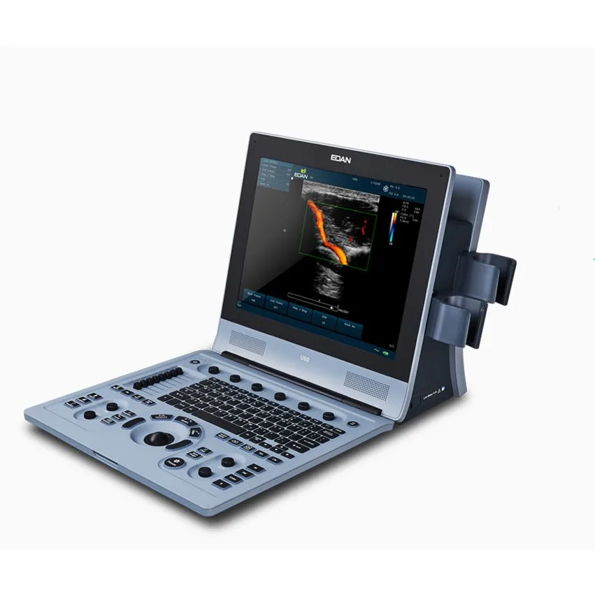 Mindray Edan Portable laptop medical U2  ultrasound machine Color Doppler ultrasound instruments machine system U60 price