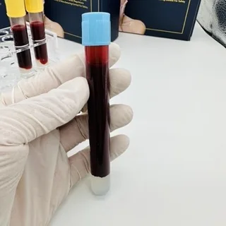 2024 new Low level laser therapy hair loss helmet laser hair loss hair regrowth