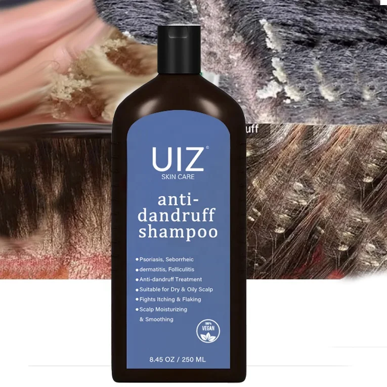 Anti Dandruff Shampoo Astragalus Licorice Root Psoriasis Seborrheic Dermatitis Scalp Treatment Care Organic Black Hair Shampoo