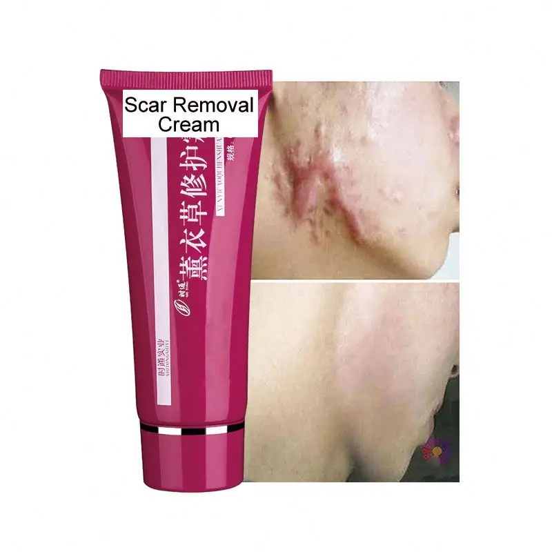 Wound treatment cream skin care women vitamin c cream for face anti wrinkle face cream