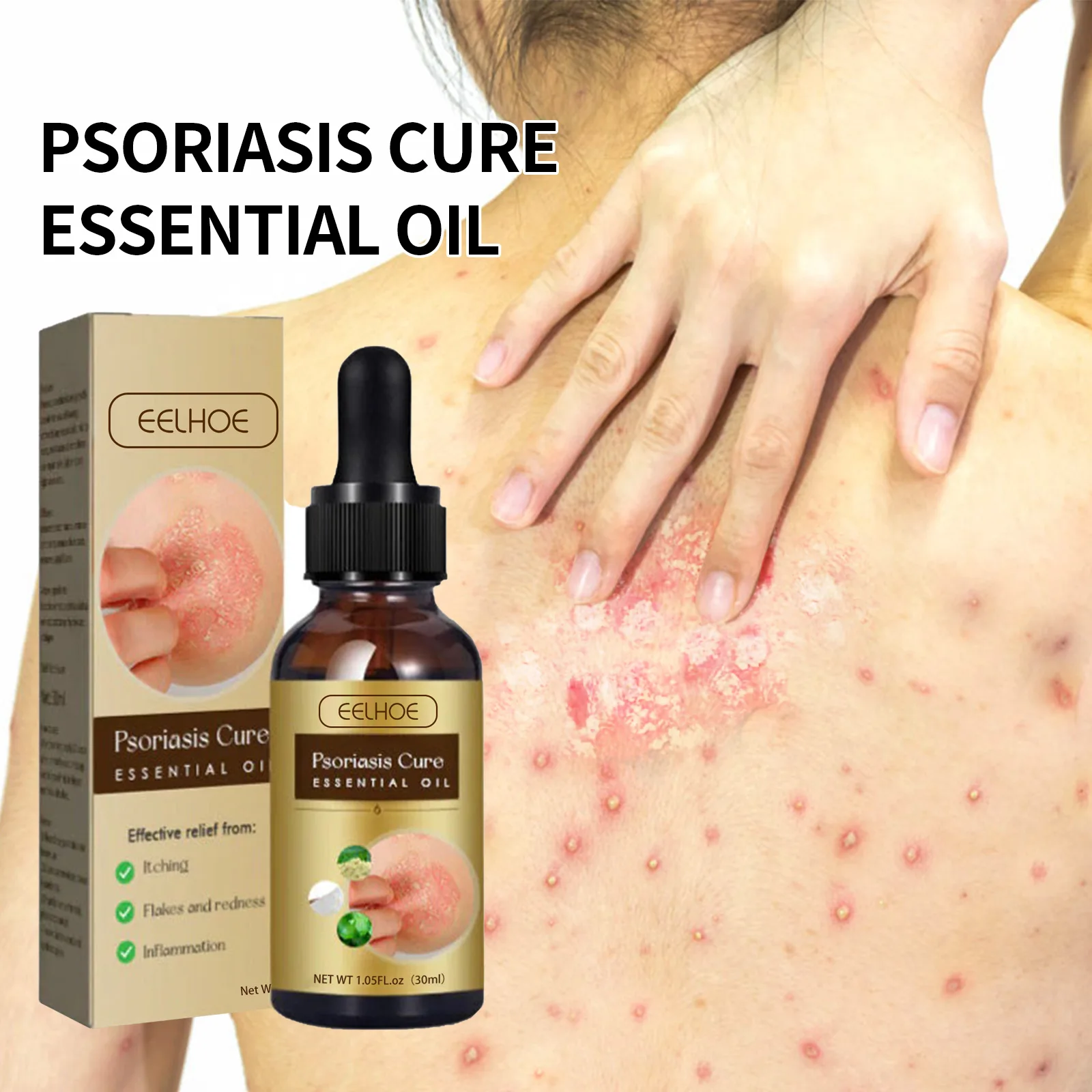 Eelhoe Private Label Skin Moss Repair Essential Oil Anti Itching Hand And Foot Skin Care Serum