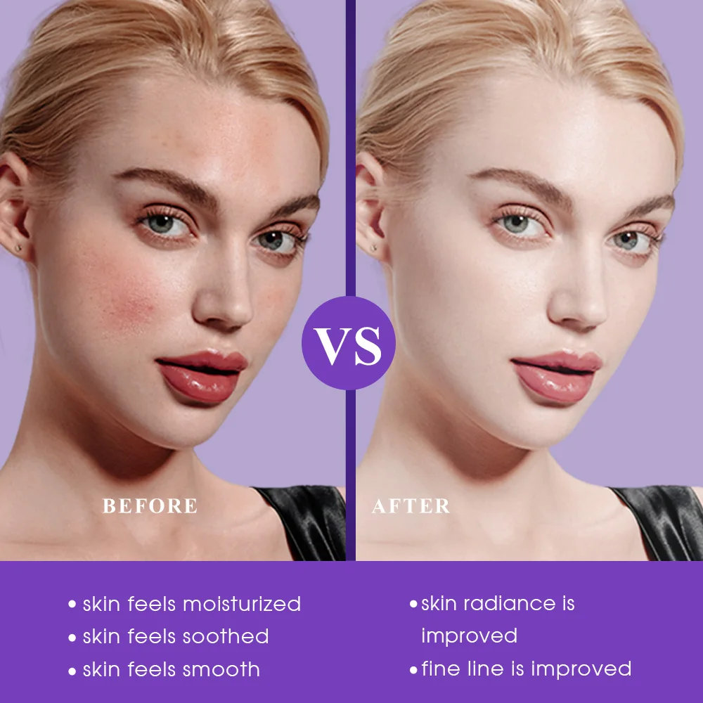 Korean Brightening Skincare Beauty Products Facial Kit Squalane Moisturizing Anti-aging Face Maintenance Skin Care Set