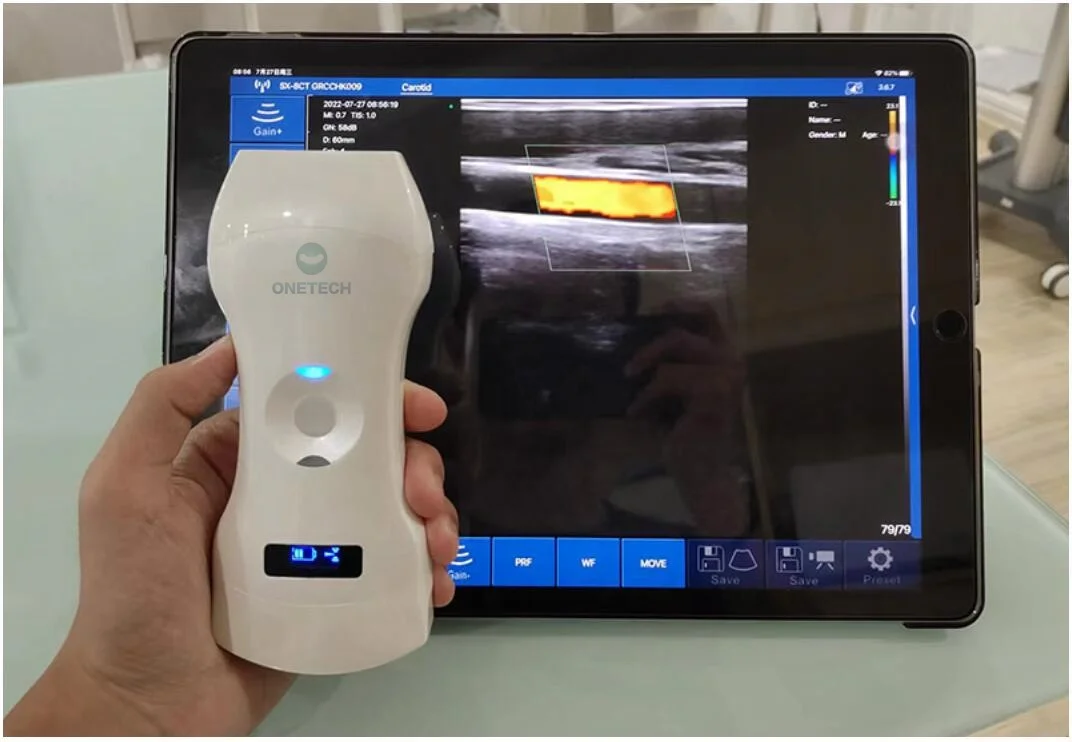 B26G Double Head Wireless Ultrasound Probe Portable Doppler Ultrasound Phased and Linear Wireless Ultrasound Scanner CE