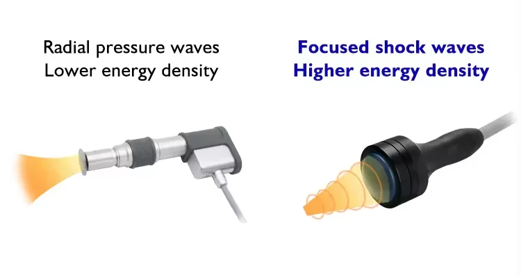 Physiotherapy Pain Relief Eswt Erectile Dysfunction Electromagnetic Focused Shockwave Therapy Machine