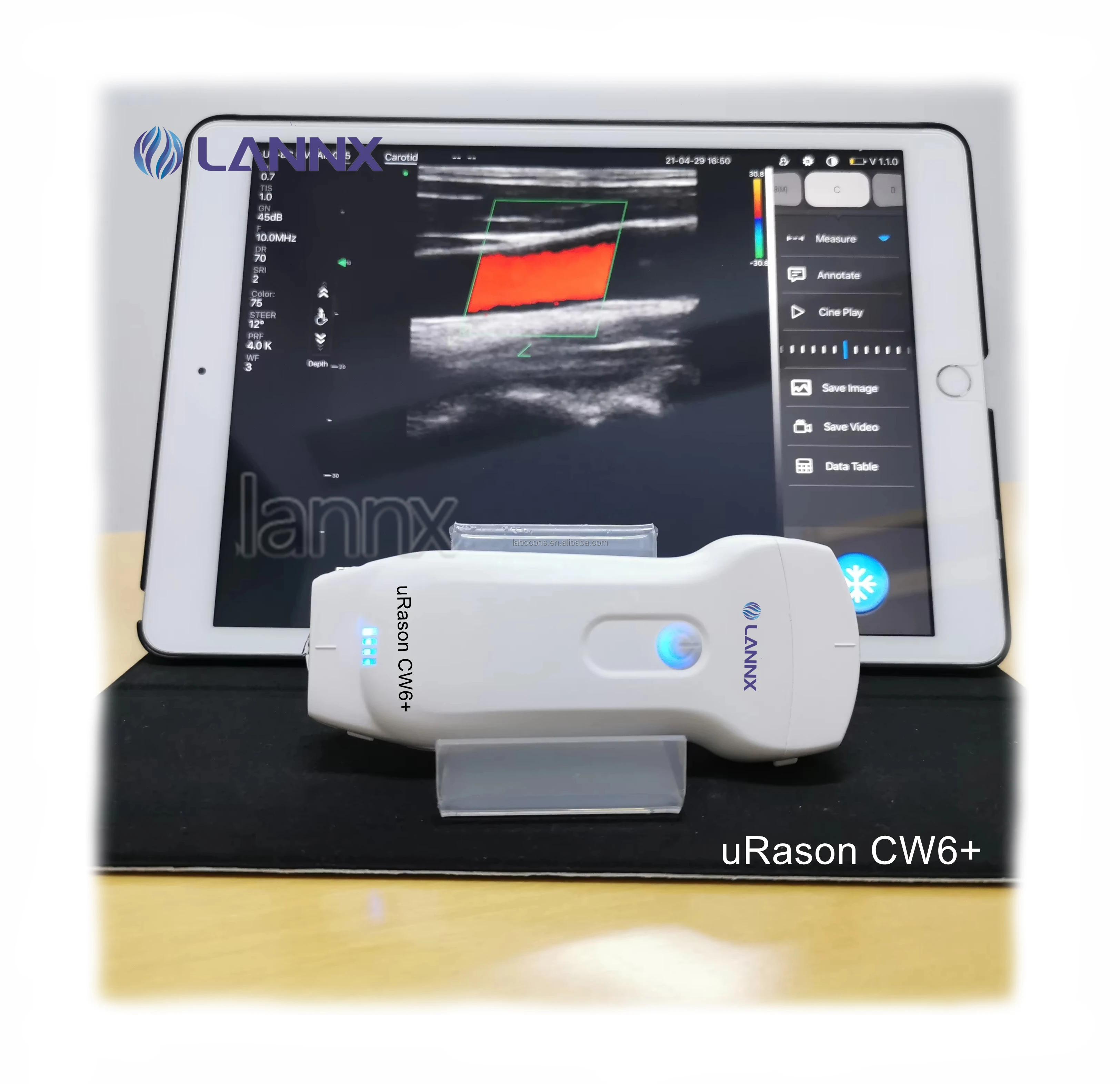LANNX uRason CW6+ New 128 elements 3 in 1 USG Wireless Ultrasound Probe Thyroid Pregnancy Cardiac Color Doppler Probe Ultrasound