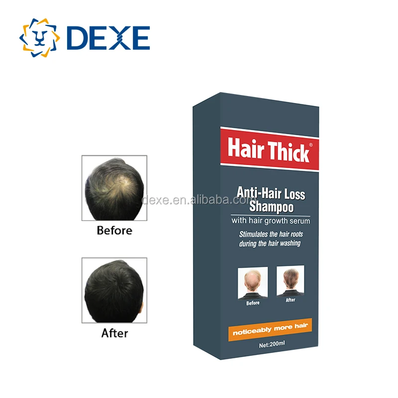 private label anti-hair loss ginger hair shampoo