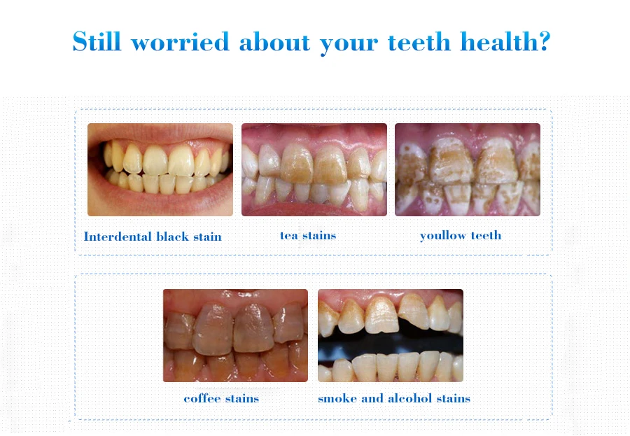 wholesale private label EFERO natural teeth whitening product foam Powder serum essence dental best teeth whitening light liquid