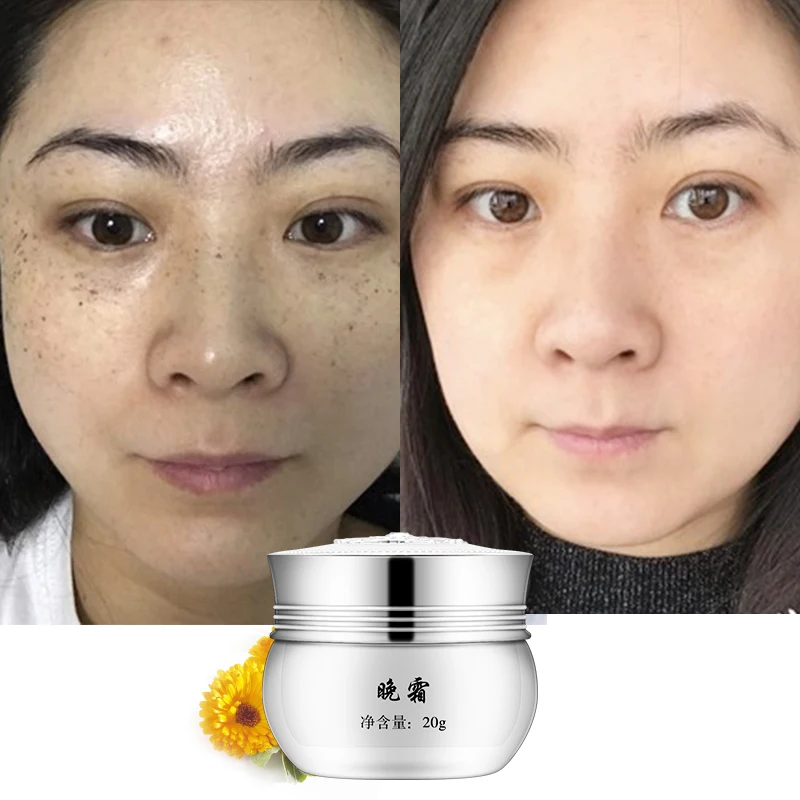 Wholesale 3 Days Whitening Face Cream For Sensitive Skin From Nigeria Dubai Sri Lanka