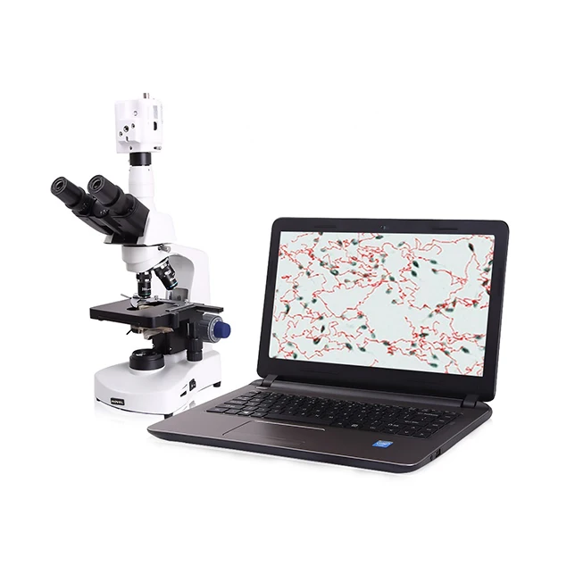 Animal sperm analyzer sperm quality analyzer