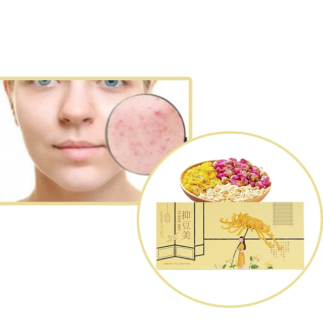 Rose Smooth Skin Herbal Honeysuckle Healthy Beauty Tea