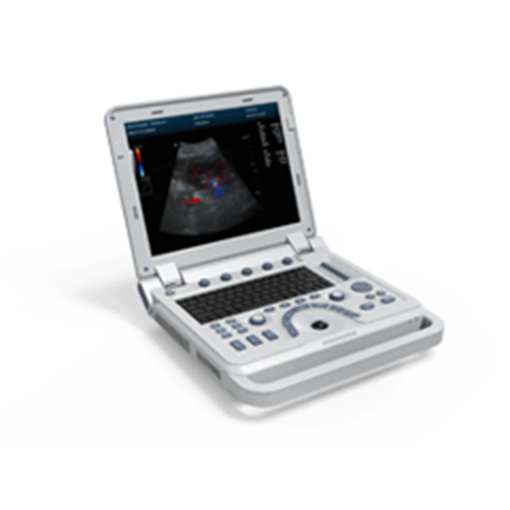 Contec CMS600P2PLUS portable ultrasound machine pseudo Color Doppler Ultrasonic Diagnostic System