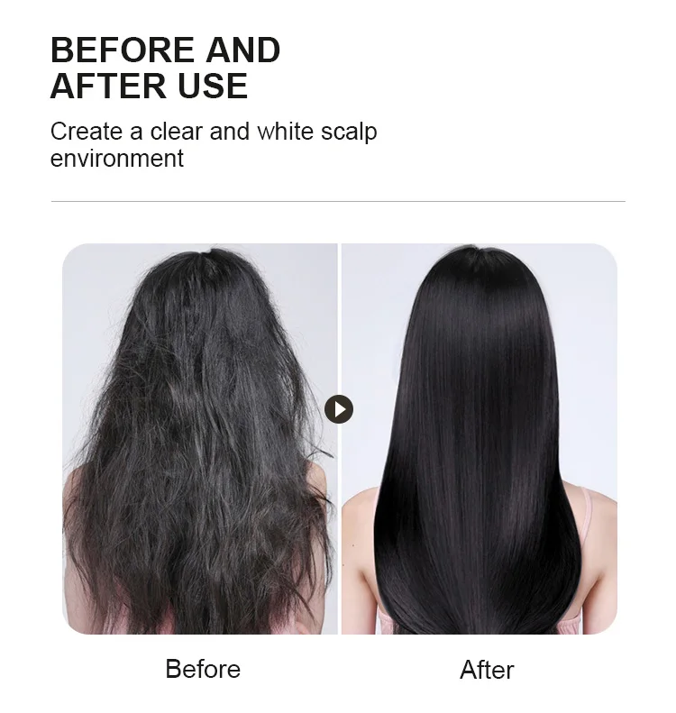 Smooth Anti Frizzy Add Shine Enhancing Nourishing Vitamin B5 Purifying Scalp Mask for Dry Damaged Hair