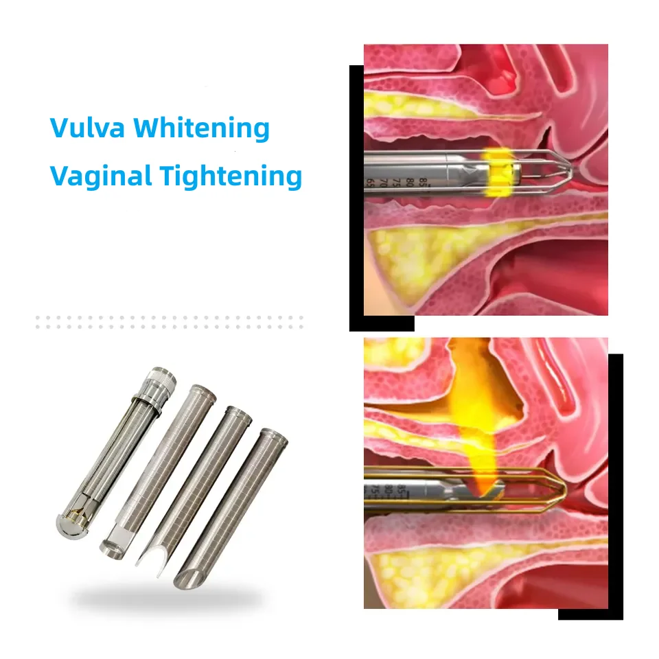 asthetice machine price marks removal co2 fractional laser for sale mini fractional co2 laser skin resurfacing machine