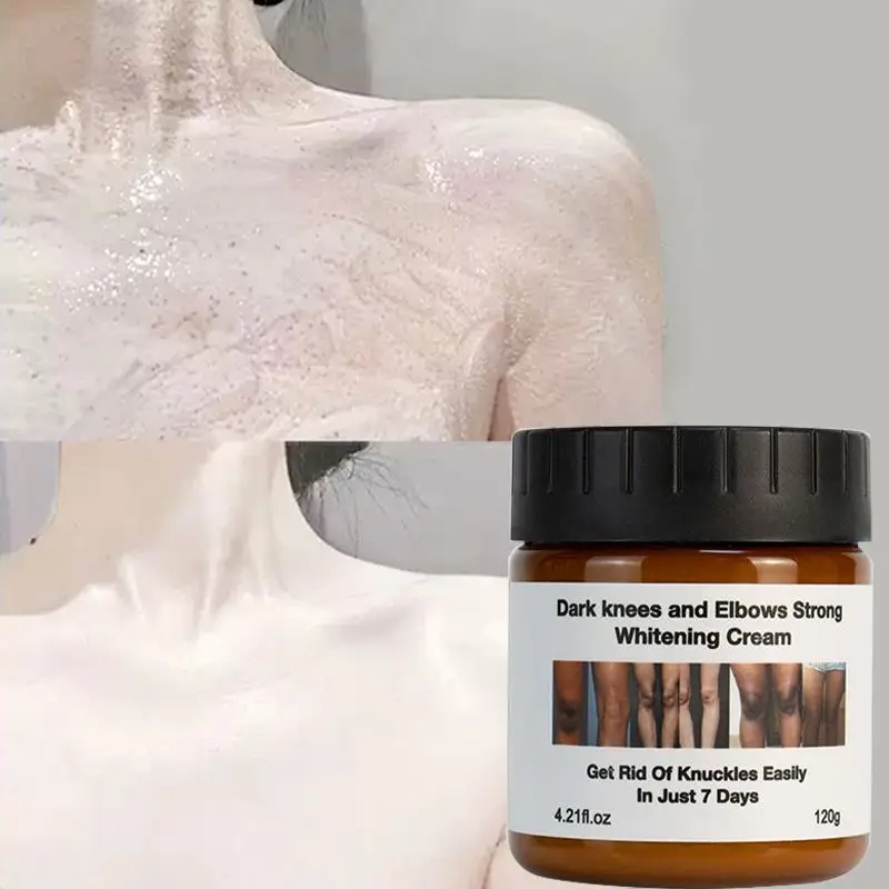 niacinamide Extreme Whitening Anti Dark Spot Aging Wrinkle Knees Elbows Strong Vitamin White Lotion Face Body Whitening Cream