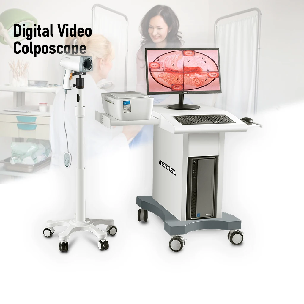 18x Optic Magnification Optical Medical Instrument Gynecology equipment Trolley type Colposcopy Vagina digital colposcope