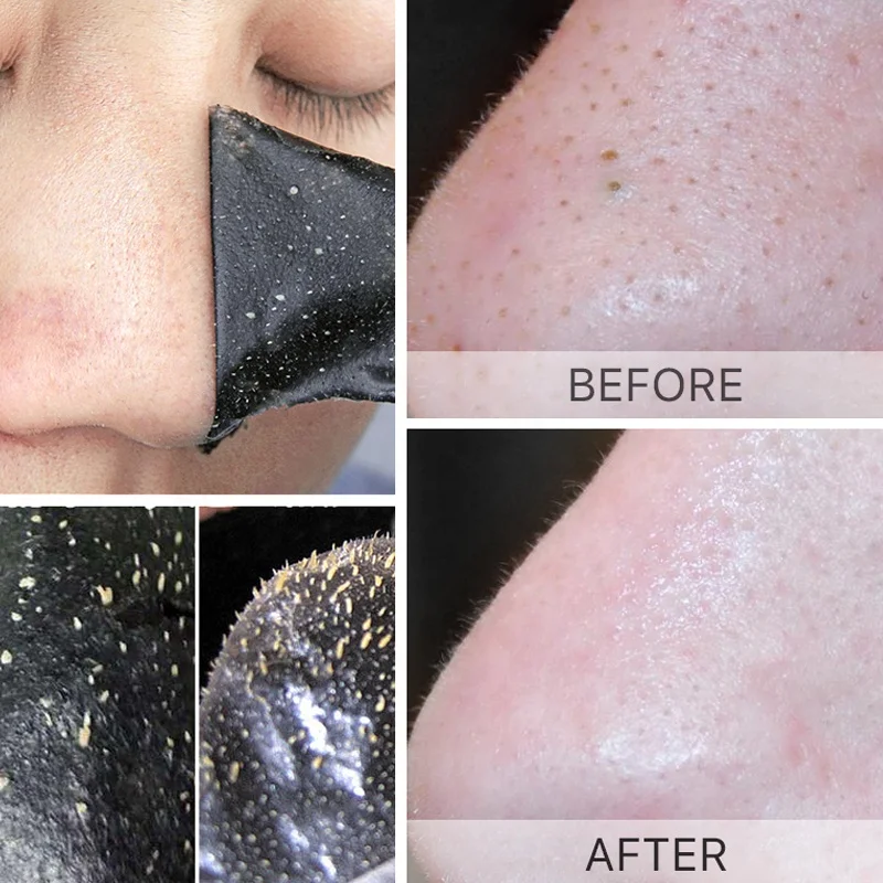 Customized Private Label Blackhead Remove Nose Strip Skin Care Deep Cleansing Shrink Pores Pore Clean Nose Strips