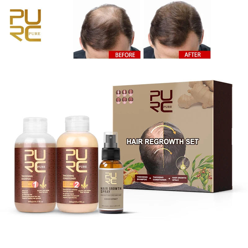 
China Manufacture natural organic ginger hair anti loss growth treatments shampoo and conditioner for men women hair fall 