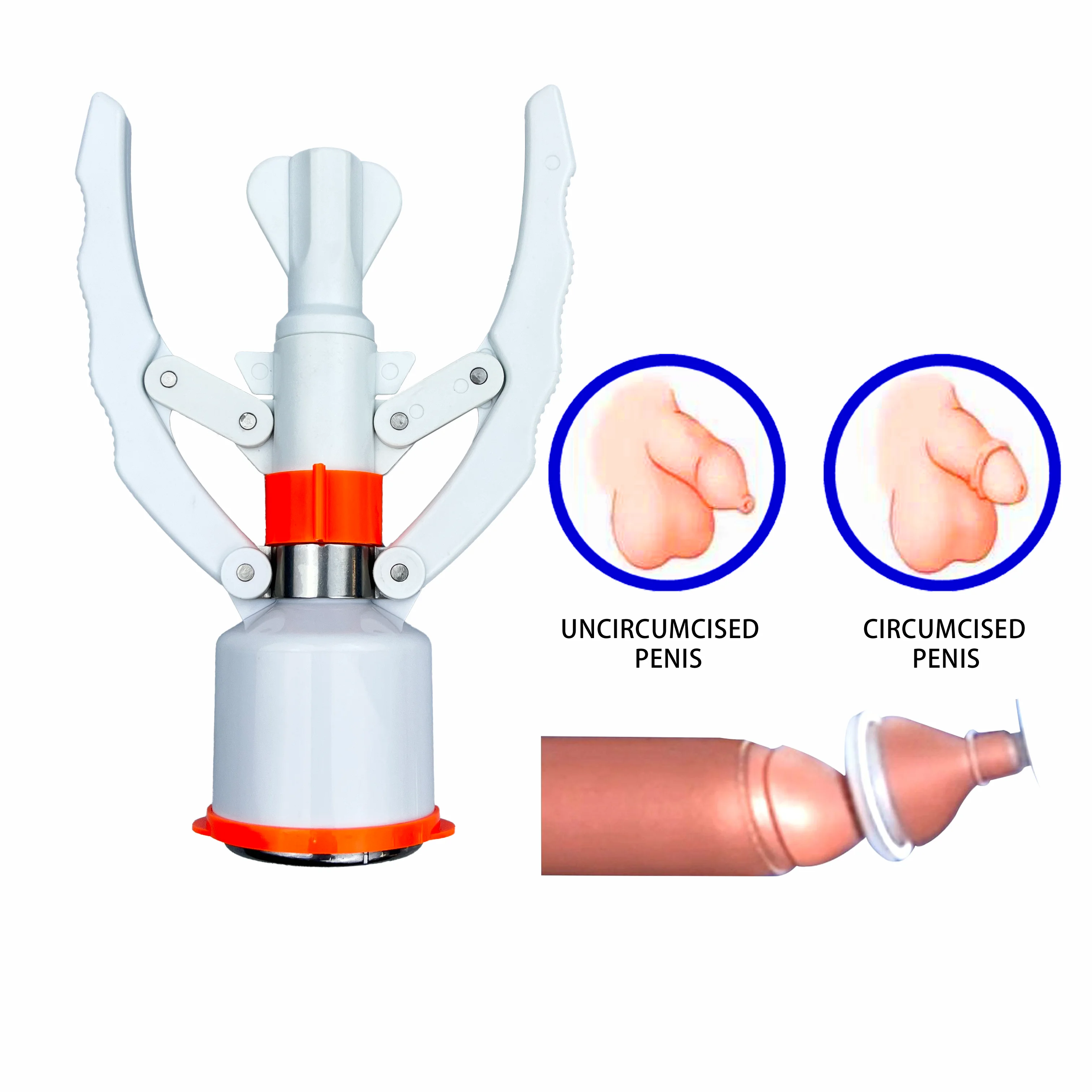 Ring Photo Plastic Disposable Circumcision Clamps