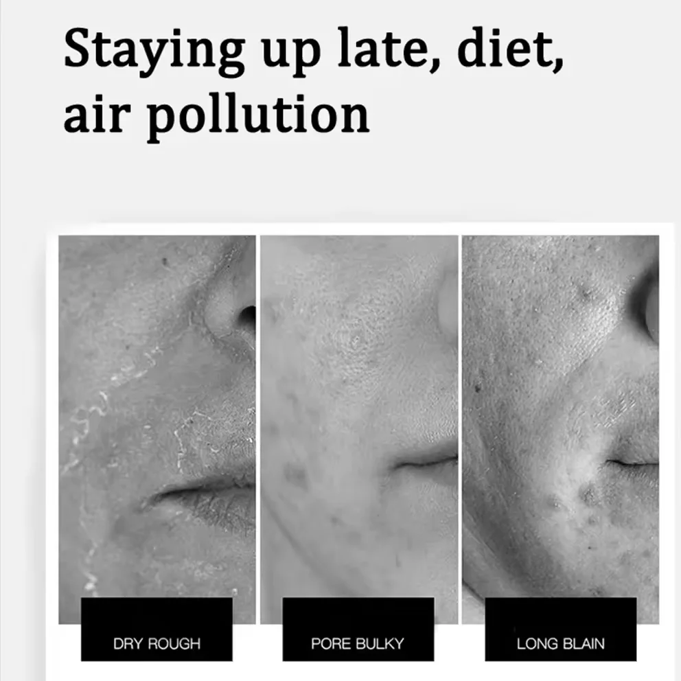 Simple Kind to Skin Refreshing Facial Cleanser Hello clear  Fwithout Cemical Skin Facewash for Dry Skin