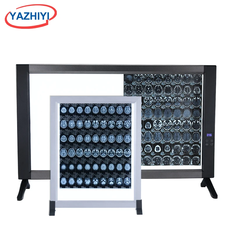 Best Quality LED Diagnosis Appliances Xray Images Ultra Thin 3 Panel Led X Ray Film Viewer