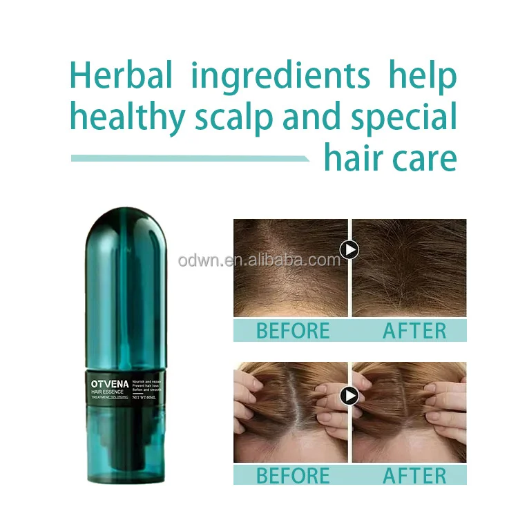Otvena human hair care smooth promote hair growth reduce hair loss serum spray