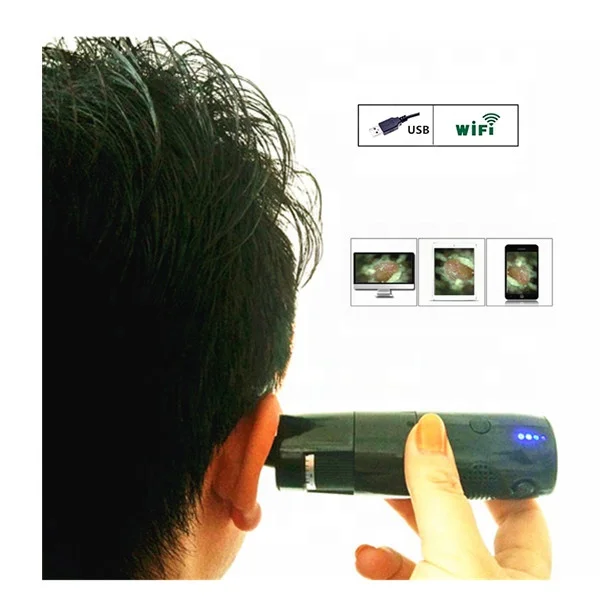 ML-OTN1 Otoscope set digital wifi microscope with USB mode HD video household wireless Endoscope to check ear and nose