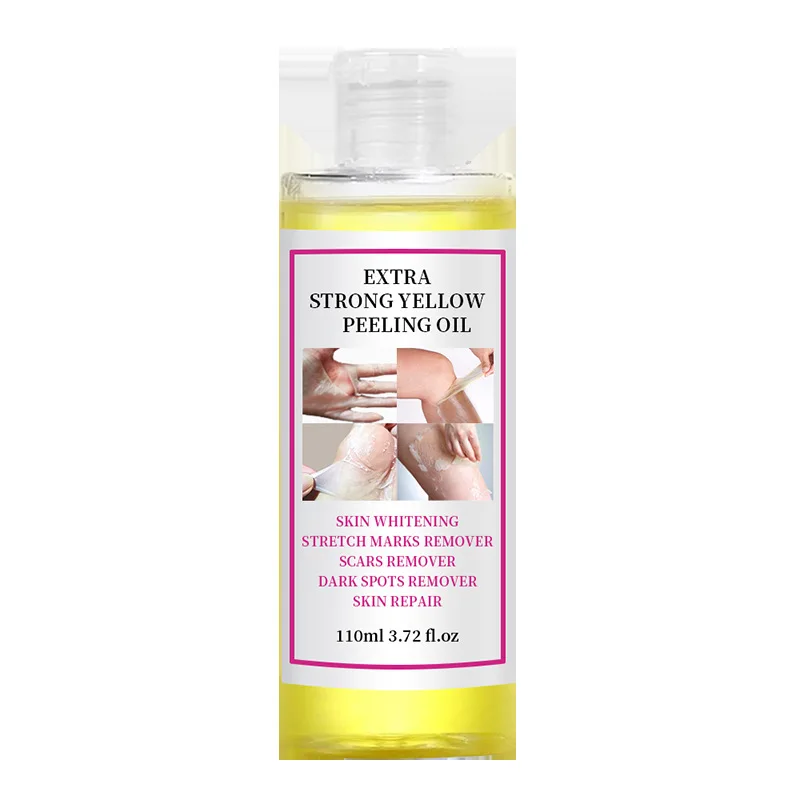 Extra Strong Peeling Oil Scar Remove Stretch Marks Exfoliating Peeling Solution Whitening Yellow Skin Lightening Peeling Oil