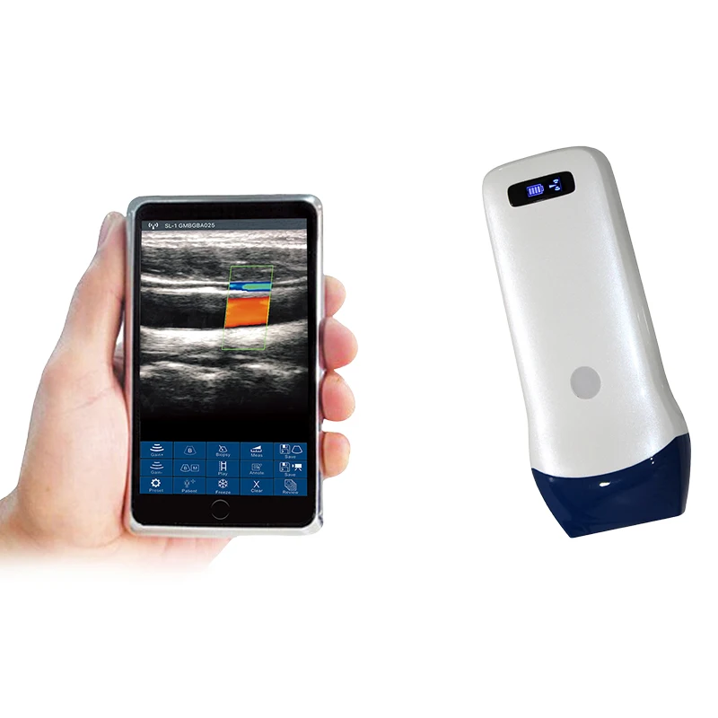 128 Elements Bladder Wireless Veterinary Pregnancy Portable Pocket Handheld Ultrasound Scanners For Women