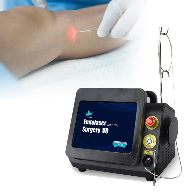 Triangel Professional Varicose Veins Removal Treatment Radial 360 degrees Optical Fibers Diode Laser