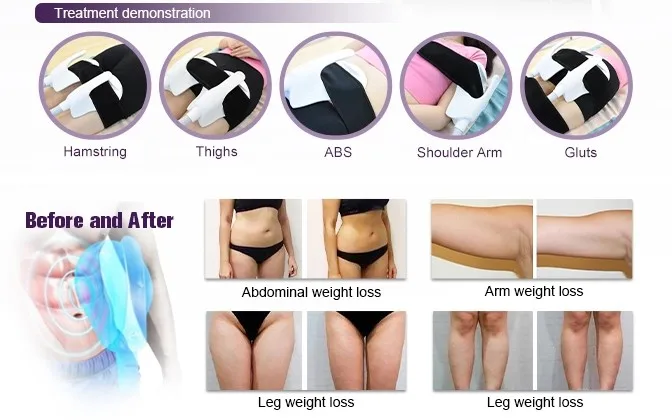 2 Handles Ems Body Sculpting machine High intensity Electromagnetic Training Muscle Machine ems muscle stimulator