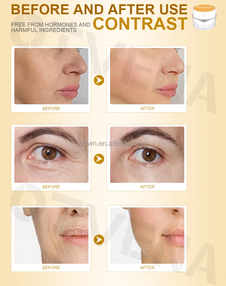 OTVENA private label face anti aging night cream