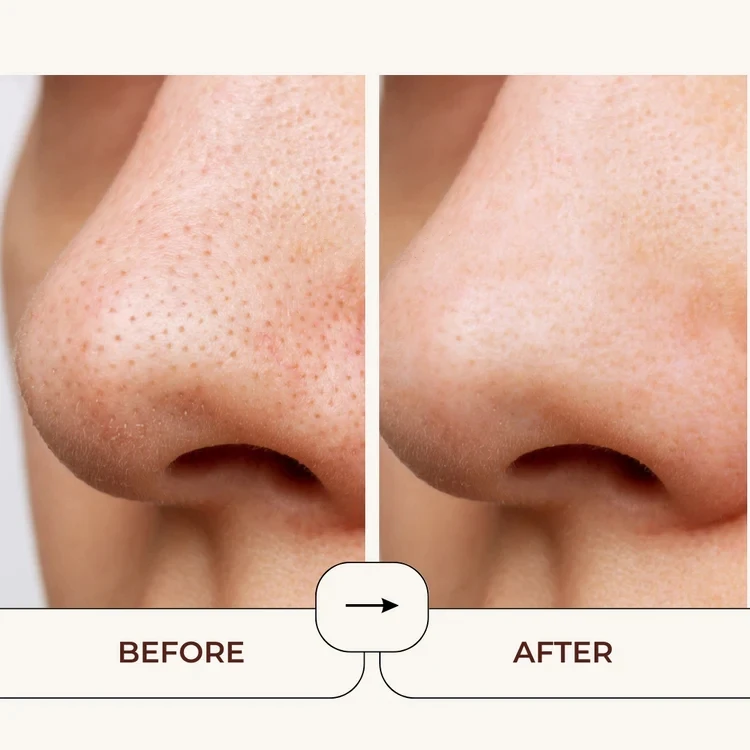 Lance Exfoliating Clay Mask Private Label Natural Pore Cleansing Blackhead Remove Scrub Mud Clay Mask For Face