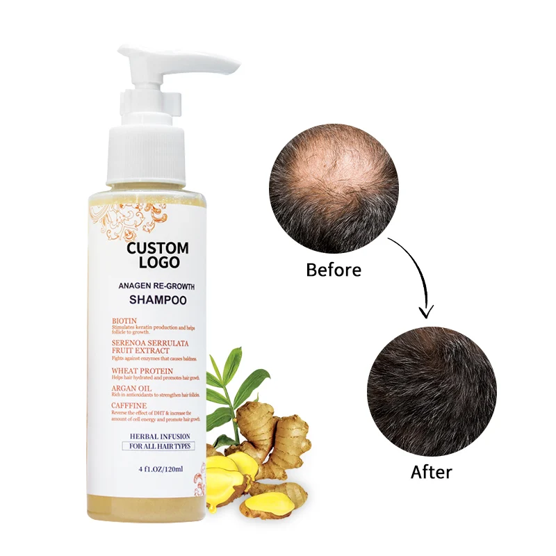 OEM handmade hair fall control care sampoo supplier the professional 100% organic alopecia treatment hair shampoo product