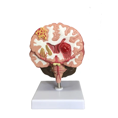 Модель удара мозга BMN/N051 (модель от болезни