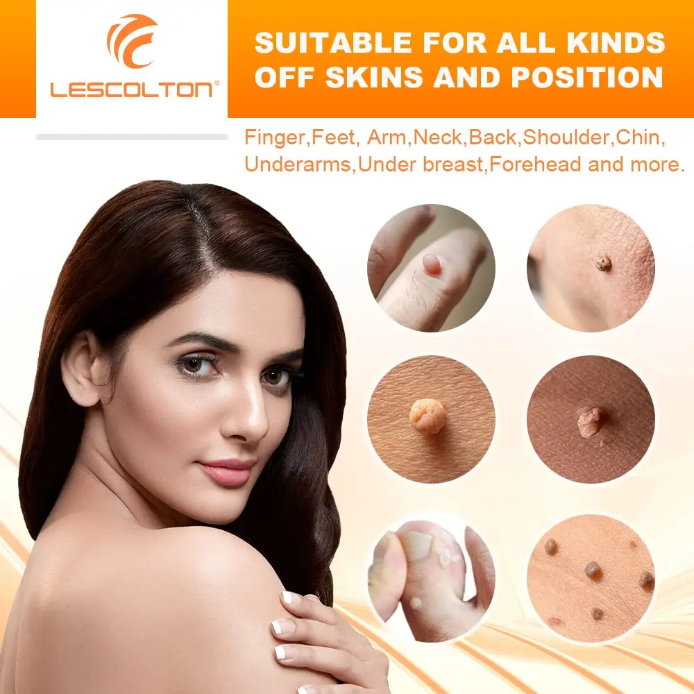 Orange Set Skin Tags Removal Kit Home Use Mole Wart Remover Equipment Micro Skin Tag Treatment Tool Easy To Clean Skin Care Tool