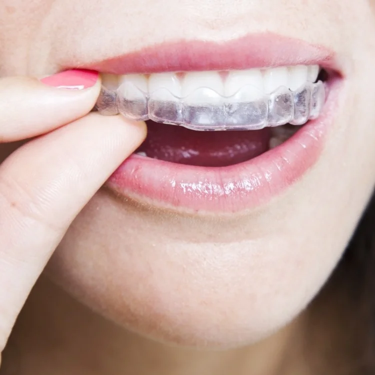 Private Custom Transparent Night Guard Gum Shield Mouth Dental Teeth Whitening Trays Thermoforming Mouth Tray