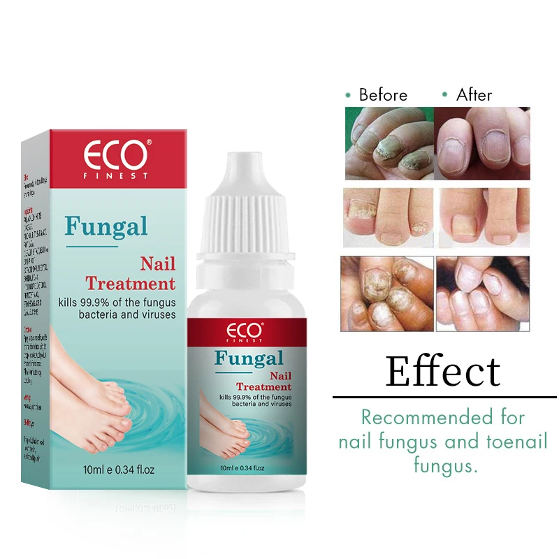 Foot Care Best Treatment Fungus Infection Remedies Liquid Toe Nail Fungus Treatment Fungal Nail Repair -281151