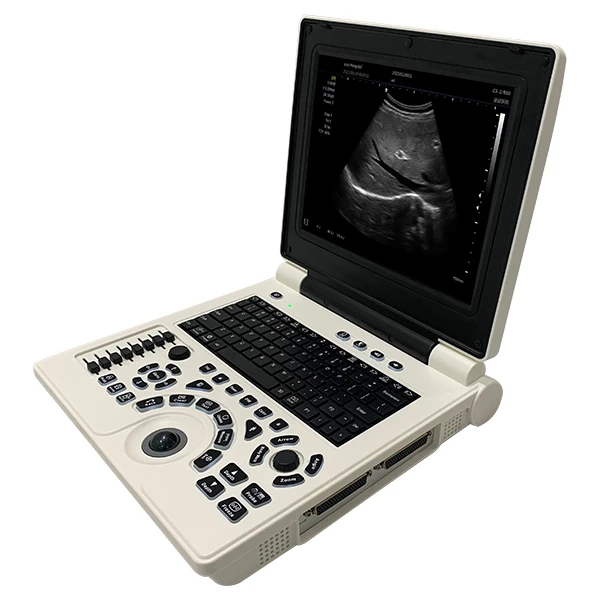 Laptop Ultrasound Scanner SS-9B