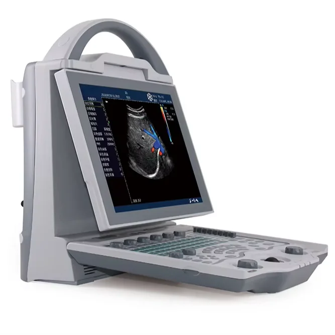 Portable Full-Digital Ultrasound Machine with Electric Power Source Medical Plastic Portable Ultrasound Scan