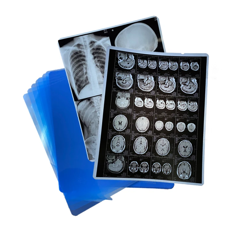 ПЭТ струйная стоматологическая рентгеновская синяя пленка для рентгеновских сухих медицинских изображений CT DR МРТ 11x14 14x17