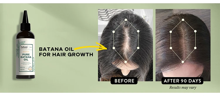 Wholesale 100% Raw And Pure Natural Batana Oil Moisture Dry Skin Hair Growth Batana Oil For Face