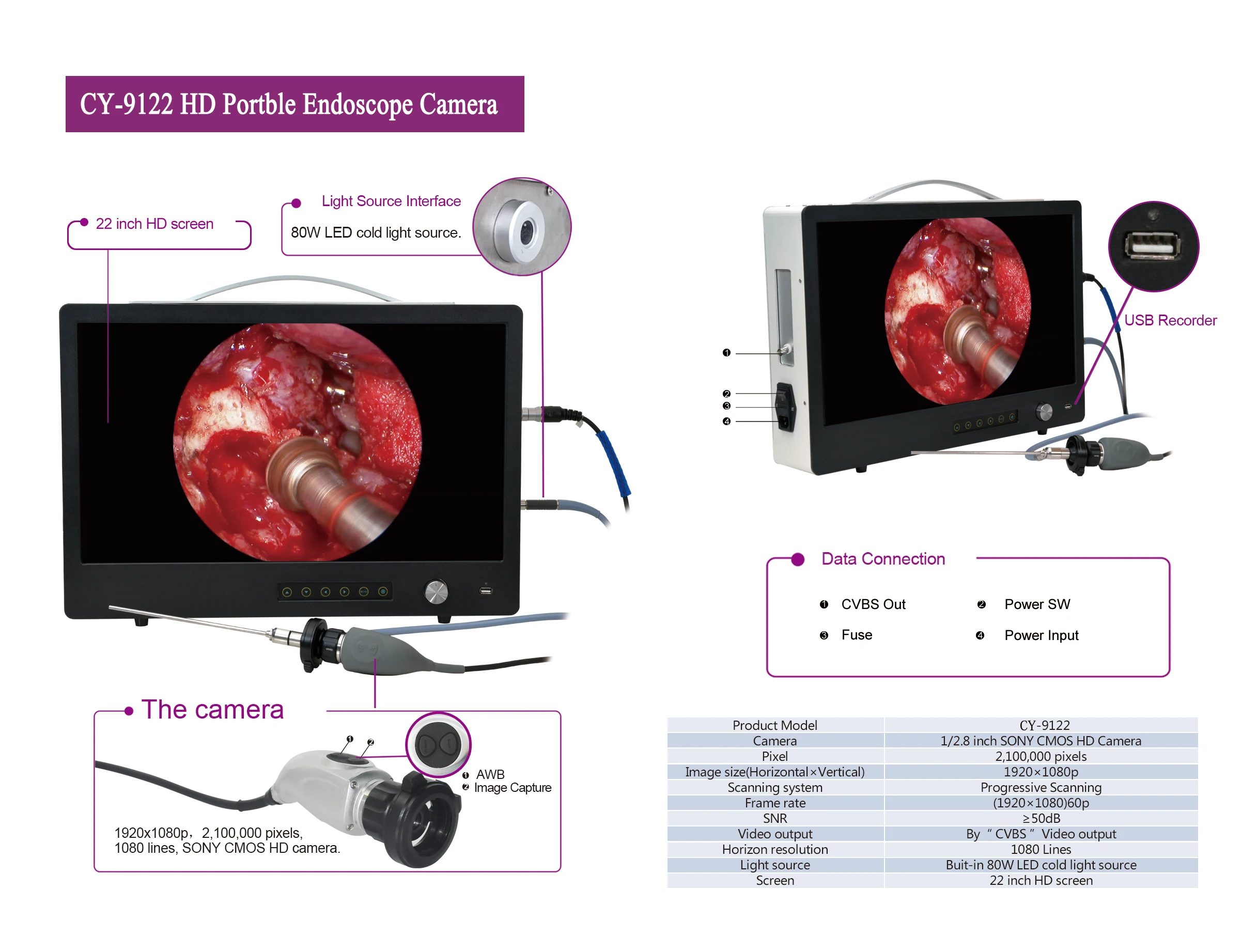 Portable 22 Inch Full Hd 1080p Endoscopic Camera With Recording Function