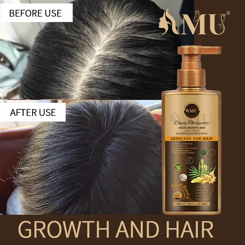 Best selling shampoo for anti hair loss fall with thinning thickening hair growth shampoo for all types hair 300ml