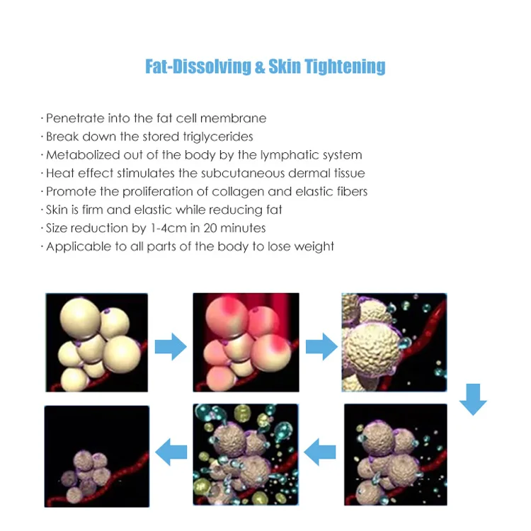 Germany Stand Parts Gurtel Shaper 40k Vaser 6d Lipo Laser